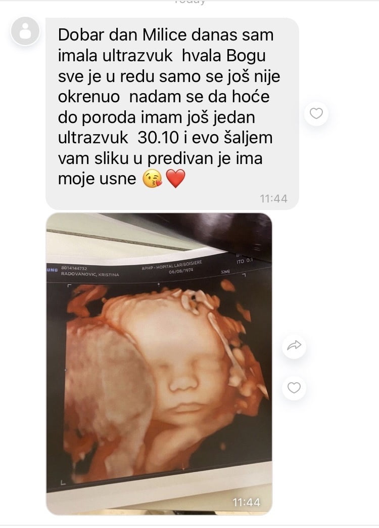 donacija jajnih celija donacija-jajnih-celija